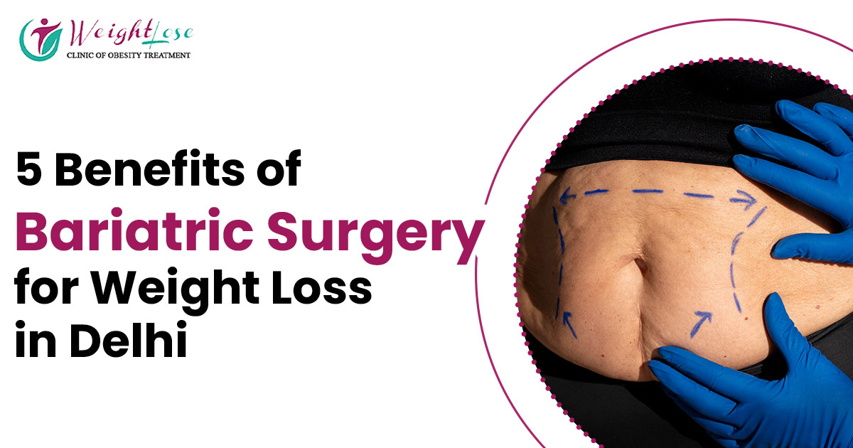 best bariatric surgeon in delhi ncr