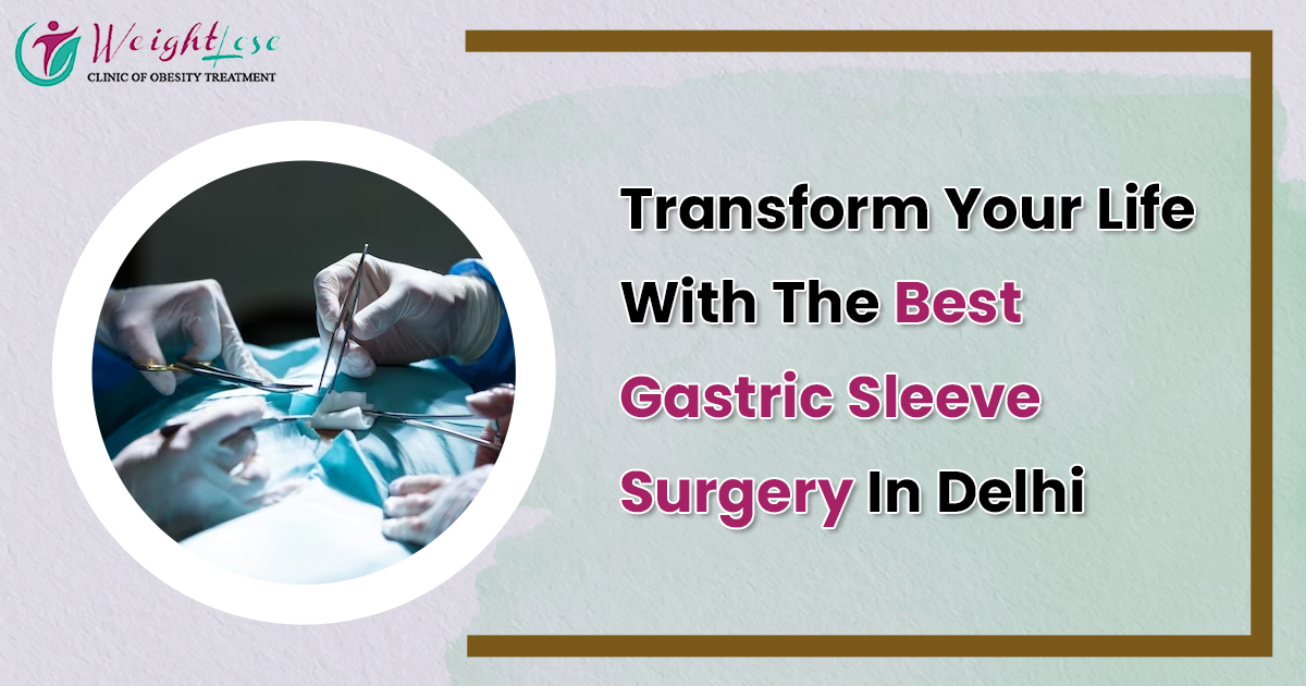 Best Gastric Sleeve Surgery in Delhi